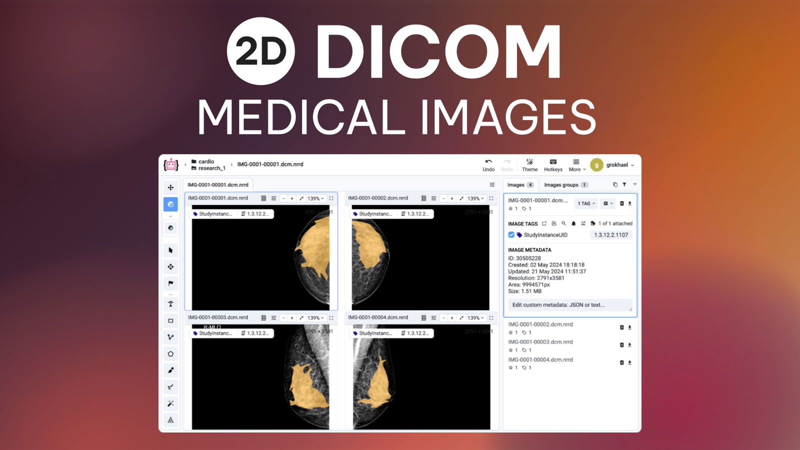 Complete guide on 2D medical image annotation in Supervisely