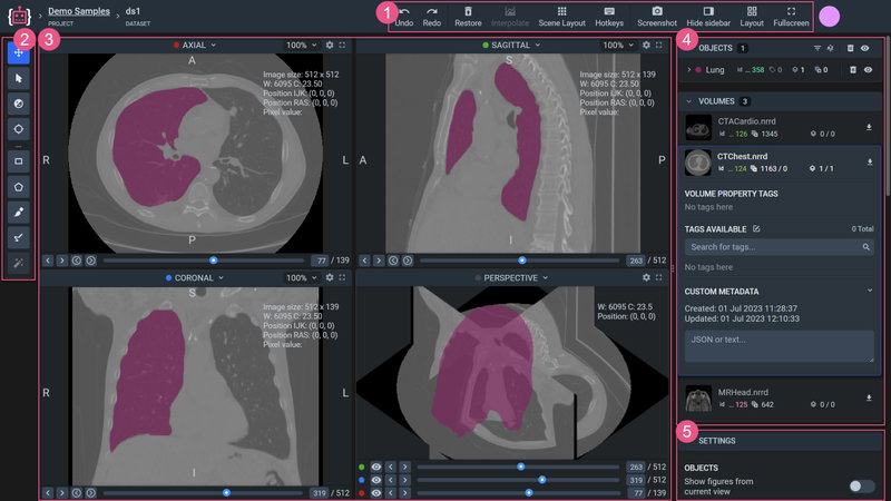 DICOM labeling toolbox interface with axial, sagittal and coronal views