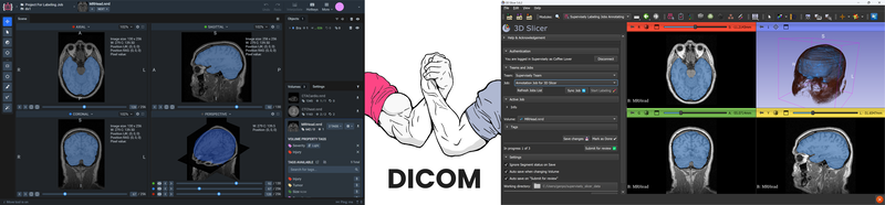 3D Slicer and Supervisely interfaces side by side