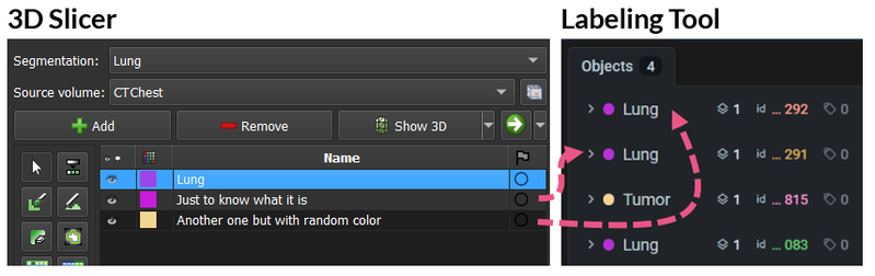 Creating a new segment in 3D Slicer