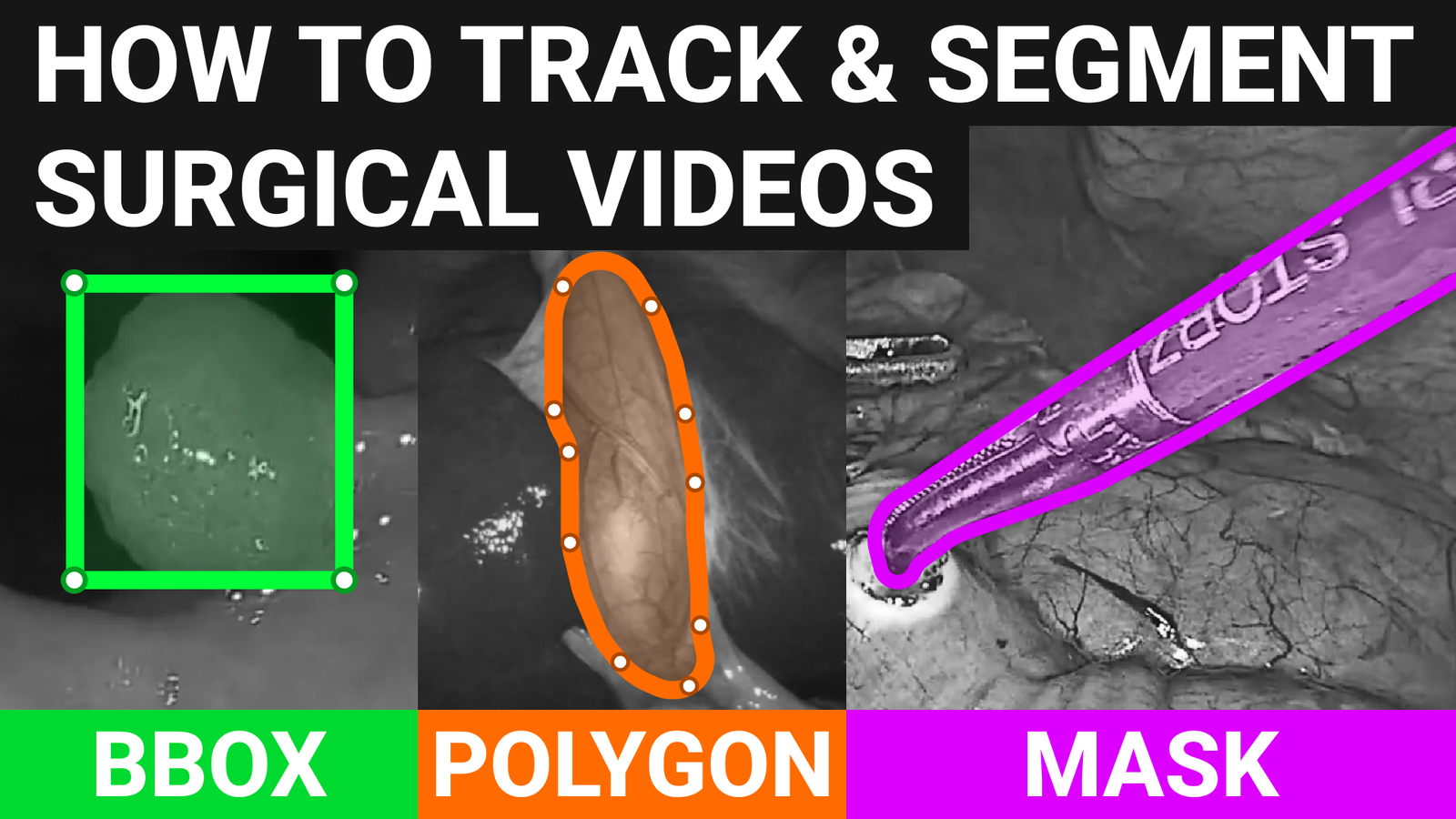 Top 5 AI tools for fast surgical video annotation in 2023