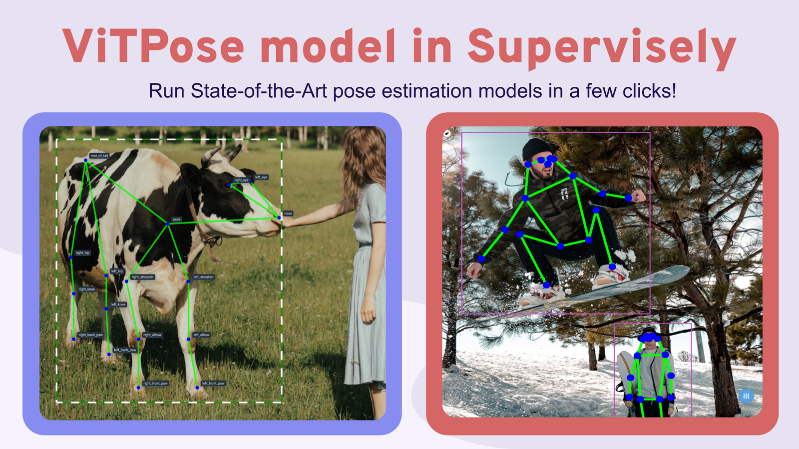 PosePipe: Open-Source Human Pose Estimation Pipeline for Clinical Research